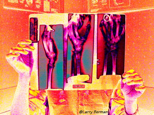 Hands XRay